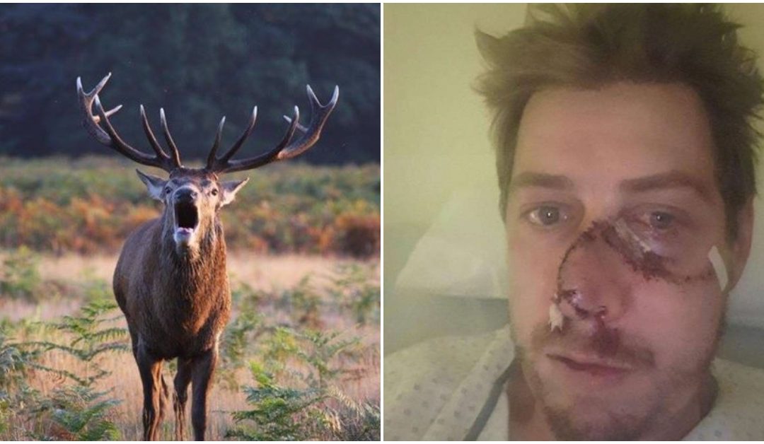 French Hunter Gets His Face Ripped Off By A Fleeing Deer