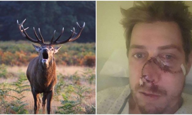 French Hunter Gets His Face Ripped Off By A Fleeing Deer