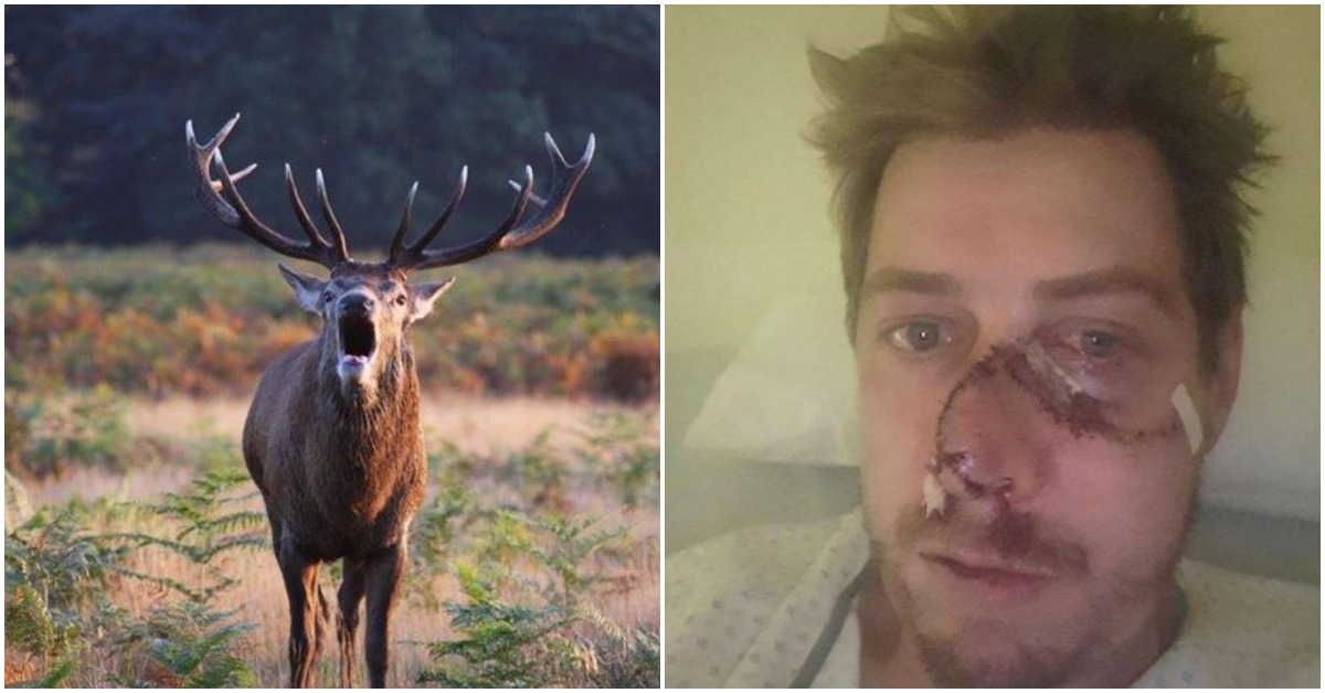 French Hunter Gets His Face Ripped Off By A Fleeing Deer