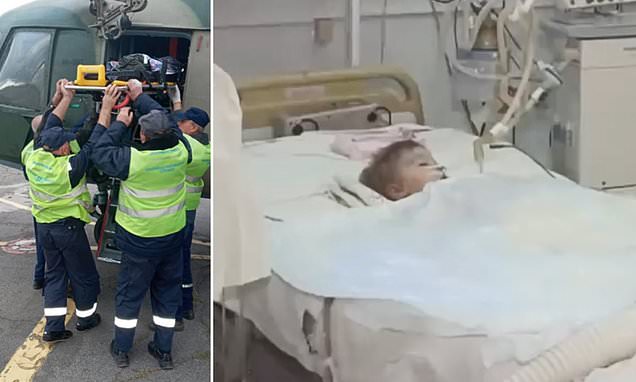 Boy, 2, is fighting for life after dogs ripped off his genitals while parents were celebrating his birthday in Ukraine